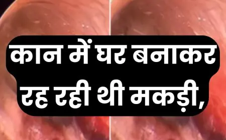 Ajab News : कान में घर बनाकर रह रही थी मकड़ी, दिल धाम कर देखे वीडियो