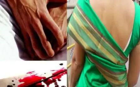 Girlfriend cut off boyfriend's private part:  शादी से मना करना प्रेमी को पड़ा भारी, प्रेमिका ने काट डाला प्राईवेट पार्ट