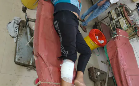 शातिर बदमाश पुलिस मुठभेड़ में पैर में गोली लगने से हुआ घायल, किया गया गिरफ्तार