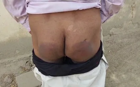 चौकी इंचार्ज ने चौकी में बुलाकर पटा से पीटा