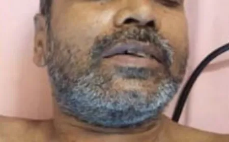 उधार ना देनें पर झोलाछाप डॉक्टर को चाकुओं से गोदा