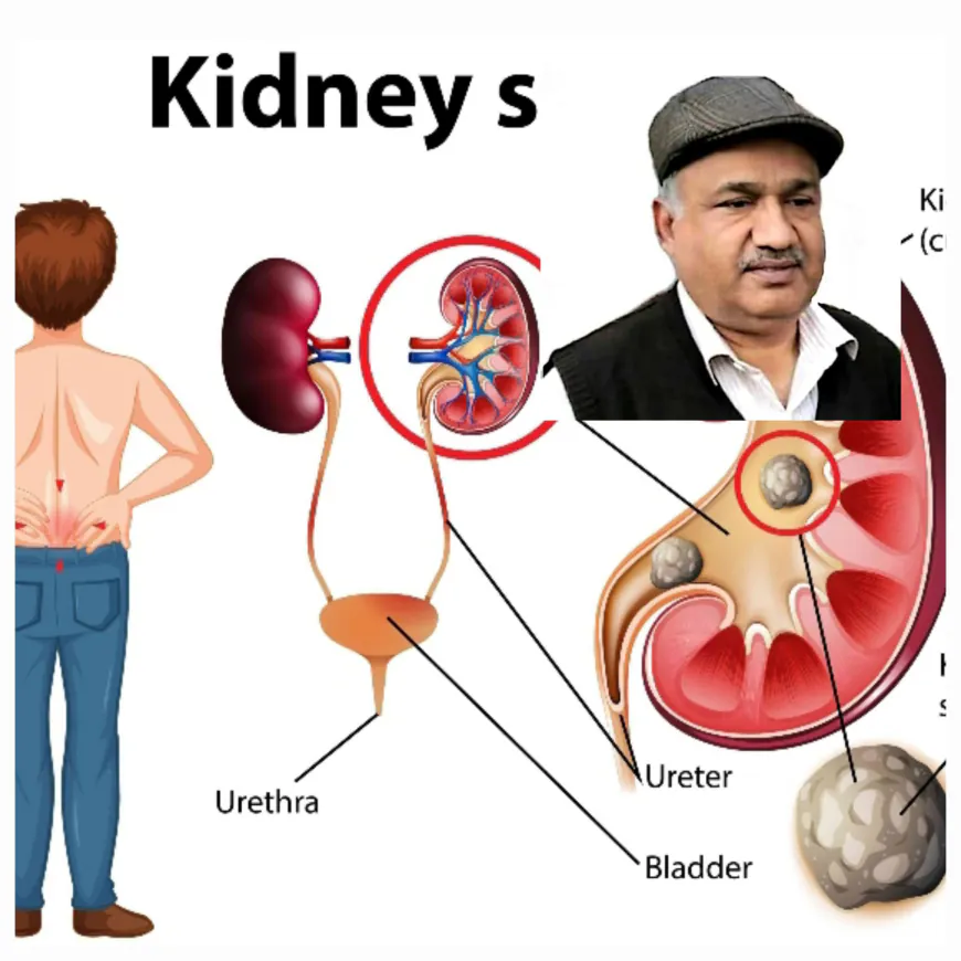 सर्दियों में क्यों बढ़ जाता है किडनी स्टोन का खतरा