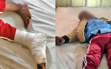 तीसरी कक्षा के छात्र को ''मुर्गा'' बनाकर पीठ पर बैठ गया टीचर, अस्पताल में भर्ती