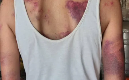 ऑल इंडिया लॉयर्स यूनियन द्वारा बीड जिले के सनगाव की महिला वकील ज्ञानेश्वरी अंजन पर हुए हमले की निंदा और कड़ी कार्रवाई की मांग