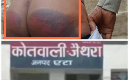 "पुलिस मित्र या जल्लाद?" – एटा में पुलिस की बर्बरता ने उड़ा दिए होश!