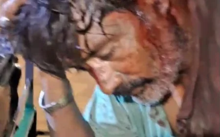 भाजपा नेत्री के बेटे पर हमला, परिजनों ने पुलिस पर लापरवाही का लगाया आरोप