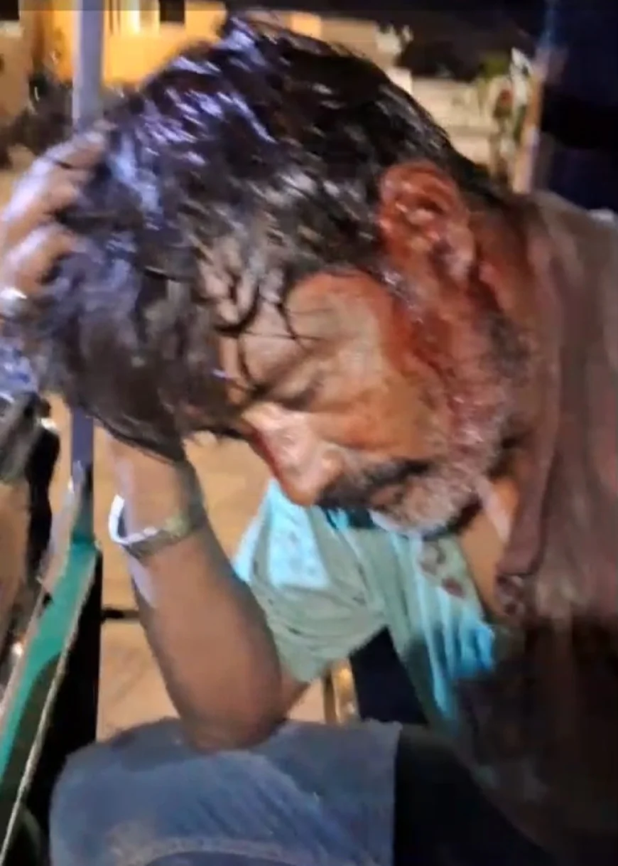 भाजपा नेत्री के बेटे पर हमला, परिजनों ने पुलिस पर लापरवाही का लगाया आरोप