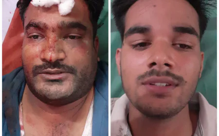 स्कार्पियो सवार दबंगों ने दो युवकों पर किया राड़ों से हमला गंभीर घायल