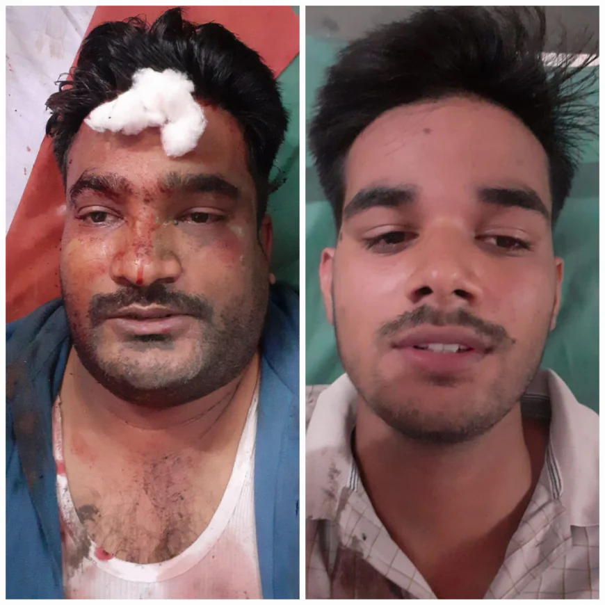 स्कार्पियो सवार दबंगों ने दो युवकों पर किया राड़ों से हमला गंभीर घायल