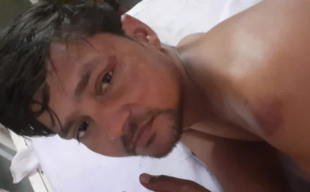 Farrukhabad News : करवा चौथ की तैयारी के दौरान पति कढ़ी की कढ़ाई में गिरा, गंभीर झुलसा