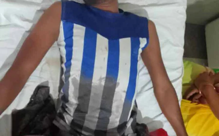 छोटी बहन से शादी करने से मना करने पर भाभी ने देवर का काटा प्राइवेट पार्ट, हुई फरार