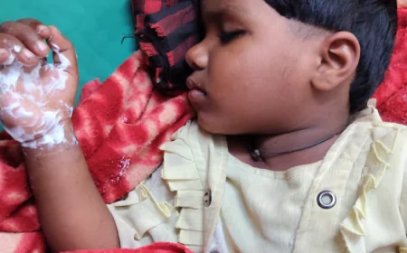 छत पर खेलती मासूम 11 हजार लाइन की चपेट में झुलसी