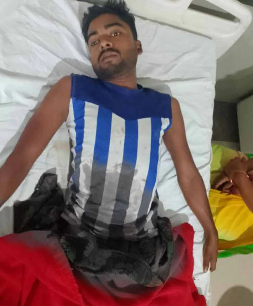 छोटी बहन से शादी करने से मना करने पर भाभी ने देवर का काटा प्राइवेट पार्ट, हुई फरार