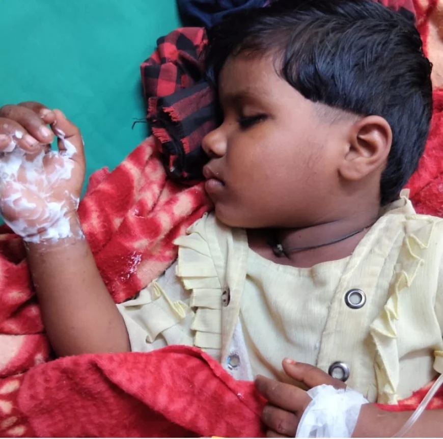 छत पर खेलती मासूम 11 हजार लाइन की चपेट में झुलसी