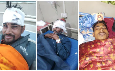 जनपद में एक्सीडेंट में आए अलग-अलग जगह से घायल