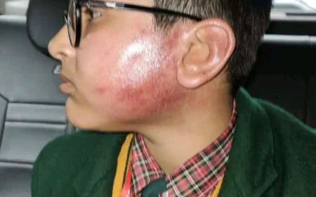 Etah News : मानवीय संवेदनाओं को तार-तार करने वाला मामला, सेंटपाल्स स्कूल पर गंभीर आरोप