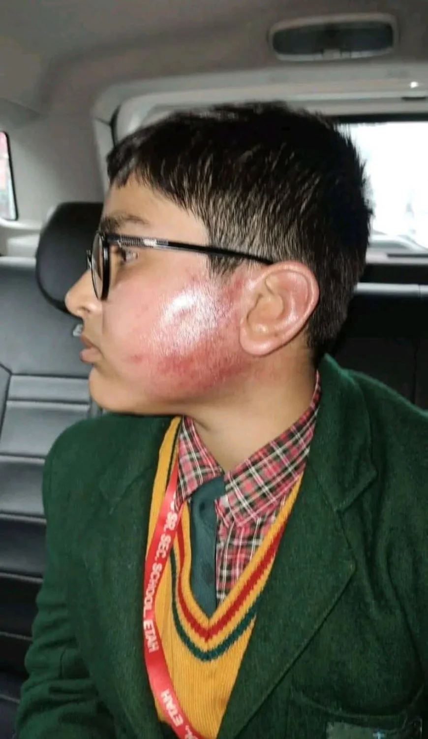 Etah News : मानवीय संवेदनाओं को तार-तार करने वाला मामला, सेंटपाल्स स्कूल पर गंभीर आरोप