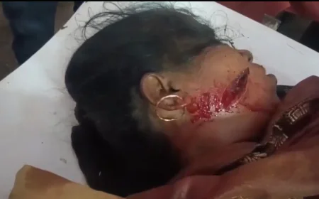 Farrukhabad News : महिला पर धारदार हथियार से हमला, आरोपी हिरासत में