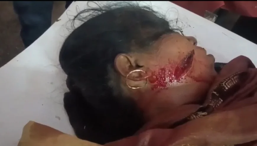 Farrukhabad News : महिला पर धारदार हथियार से हमला, आरोपी हिरासत में