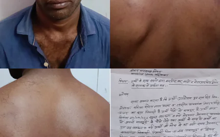 कायमगंज में मारपीट व लूट की वारदात, क्षेत्र में आक्रोश