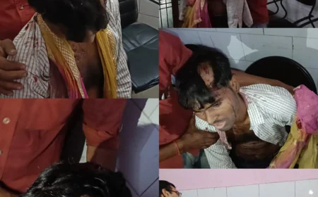 घर के बाहर युवक पर जानलेवा हमला, सिर पर डंडा मारकर किया लहूलुहान