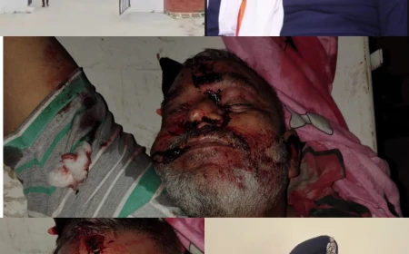 नोएडा में फर्रुखाबाद के ट्रांसपोर्ट कारोबारी की दिनदहाड़े गोलियों से हत्या, पड़ोसियों पर आरोप — क्या पुलिस हत्यारों को बचा रही है?