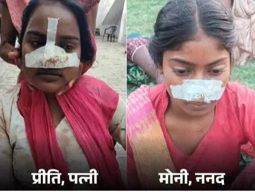 पत्नी की नाक काटने  के बाद सास ने ननद की काटी नाक