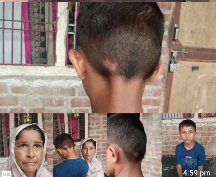 मदरसे में मासूम छात्र के बाल नोचने का आरोप, रोते हुए घर पहुंचा बच्चा; मां ने डीएम से लगाई न्याय की गुहार