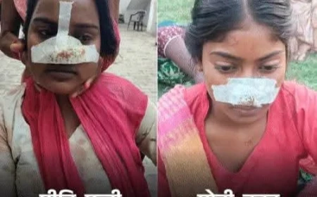 पत्नी की नाक काटने  के बाद सास ने ननद की काटी नाक