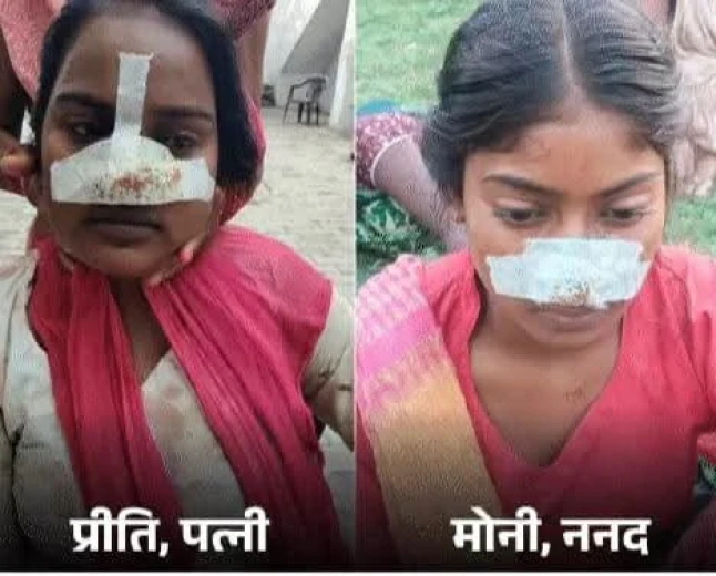 पत्नी की नाक काटने  के बाद सास ने ननद की काटी नाक